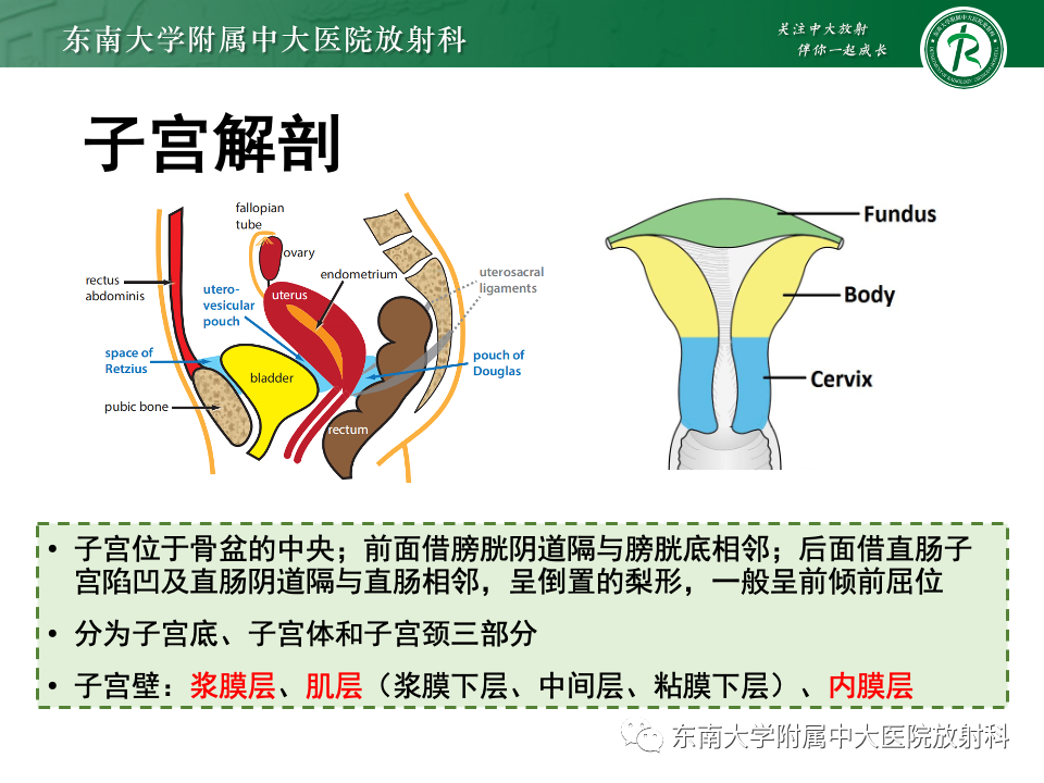 影像PPT - 【PPT】子宫内膜癌-18 影像PPT - 【PPT】子宫内膜癌-18