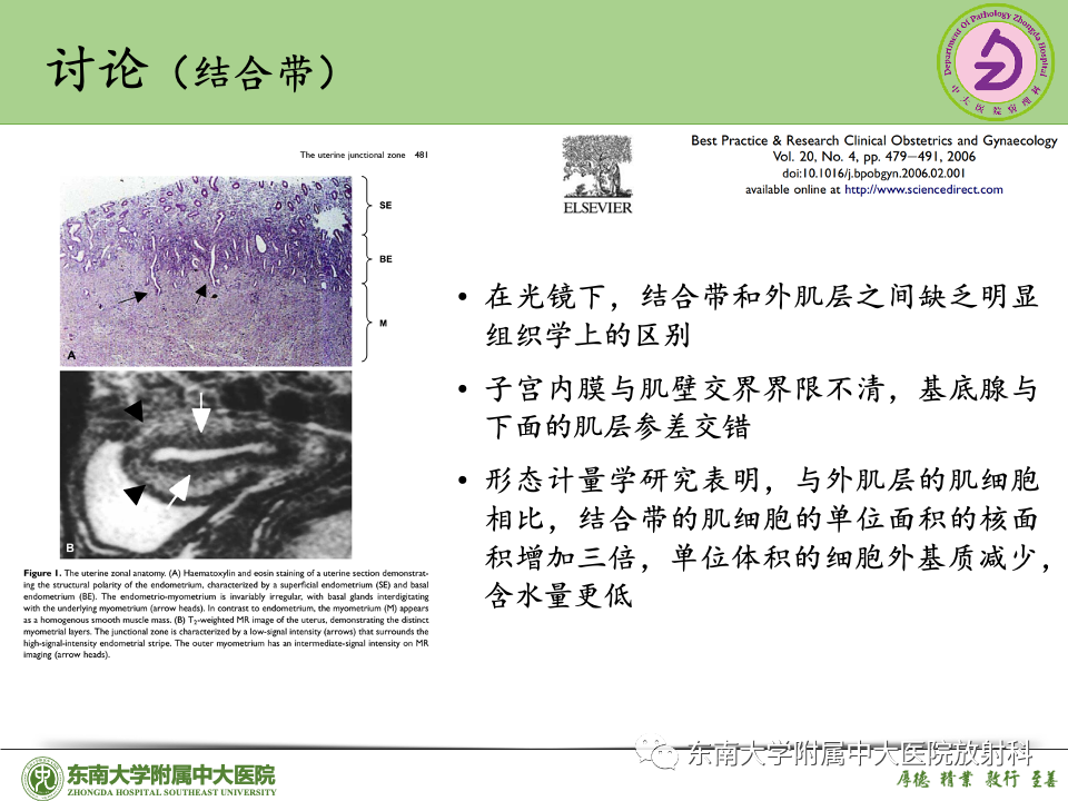 影像PPT - 【PPT】子宫内膜癌-47 影像PPT - 【PPT】子宫内膜癌-47