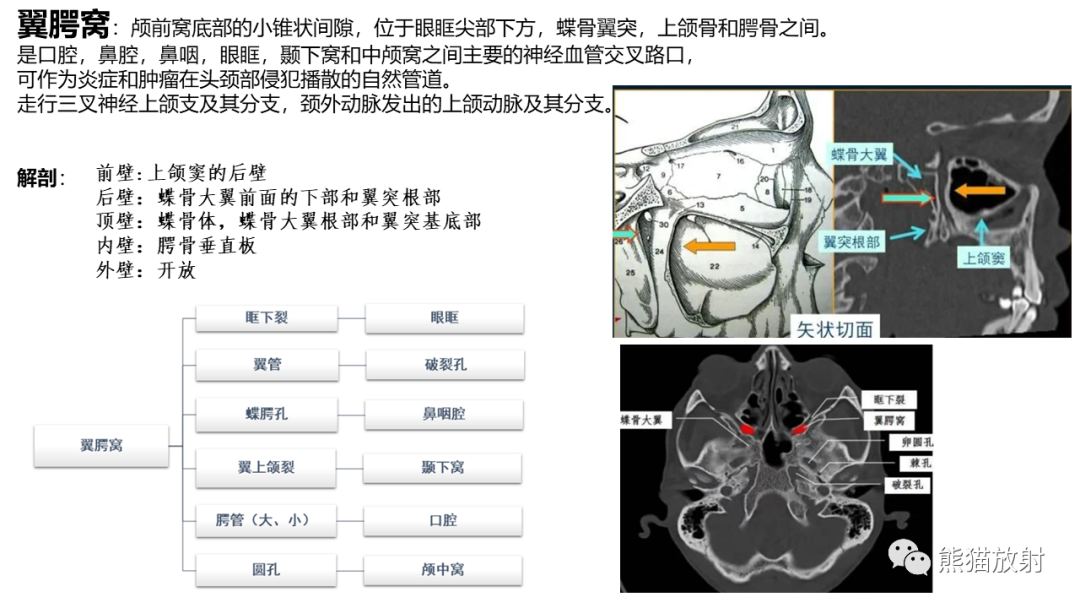 影像PPT - 【病例】鼻咽纤维血管瘤 VS 神经鞘瘤-13