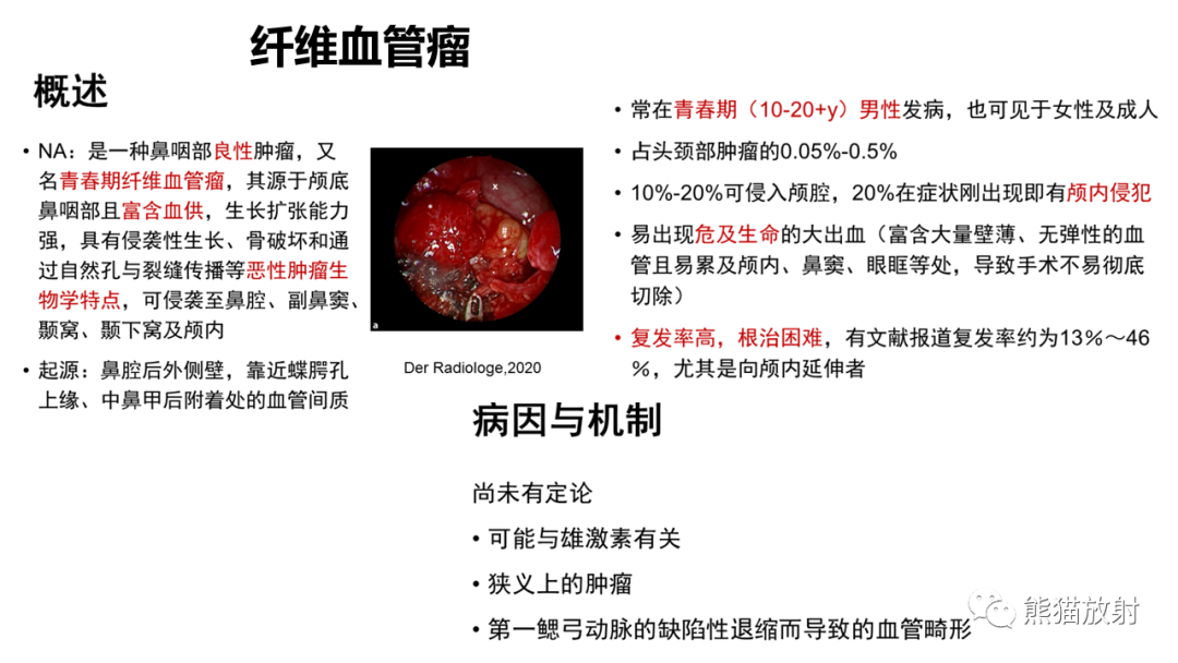 影像PPT - 【病例】鼻咽纤维血管瘤 VS 神经鞘瘤-18
