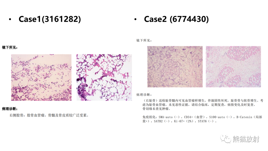 影像PPT - 【病例】骨血管瘤2例X线CT及MR影像-13