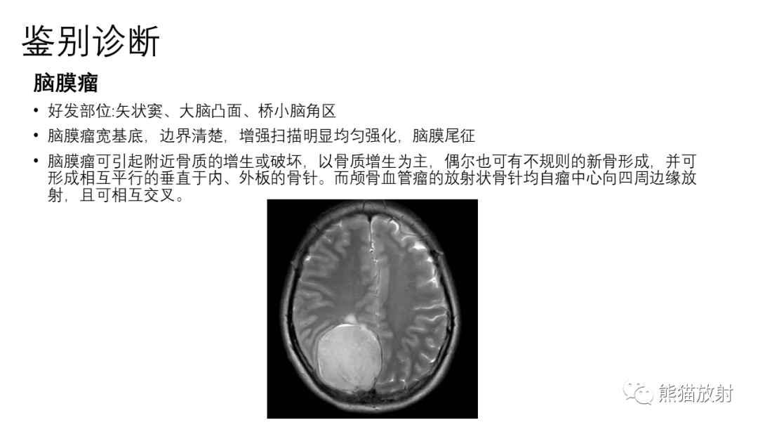 影像PPT - 【病例】骨血管瘤2例X线CT及MR影像-31