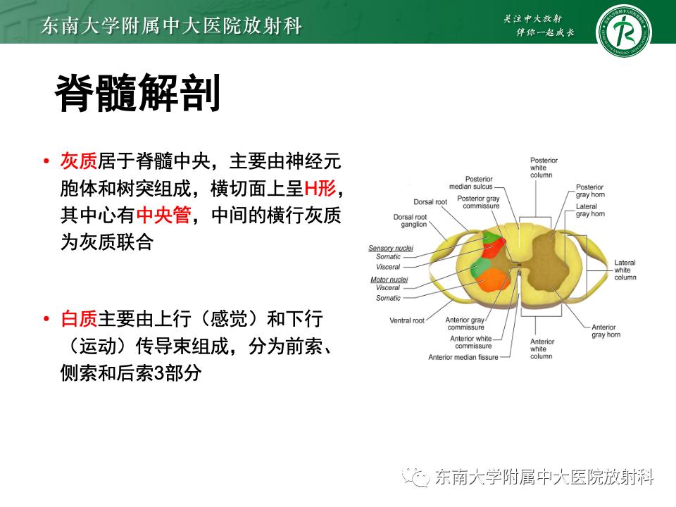 影像PPT - 【PPT】脊髓星形细胞瘤-14