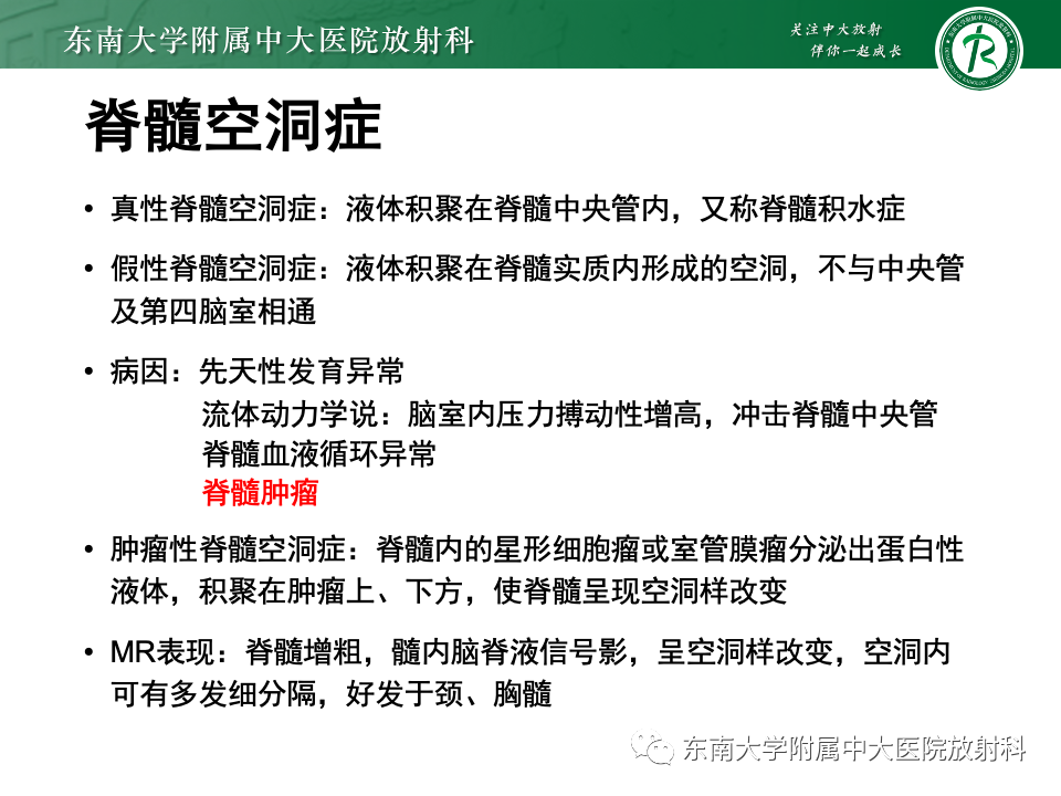 影像PPT - 【PPT】脊髓星形细胞瘤-20