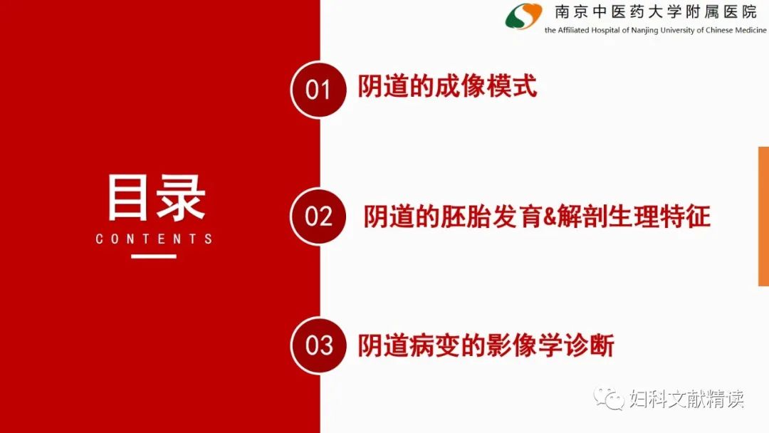 影像PPT - 【PPT】阴道病变影像诊断汇总-4 影像PPT - 【PPT】阴道病变影像诊断汇总-4