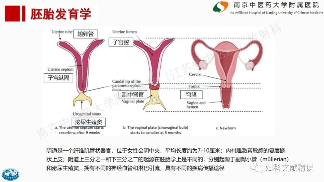 影像PPT - 【PPT】阴道病变影像诊断汇总-8 影像PPT - 【PPT】阴道病变影像诊断汇总-8