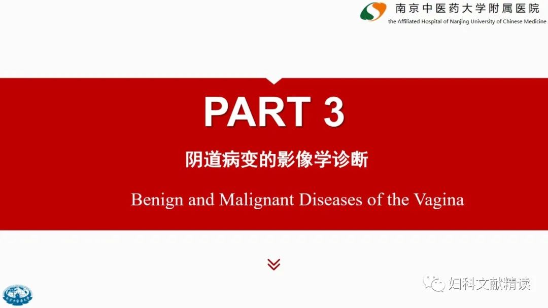 影像PPT - 【PPT】阴道病变影像诊断汇总-10 影像PPT - 【PPT】阴道病变影像诊断汇总-10