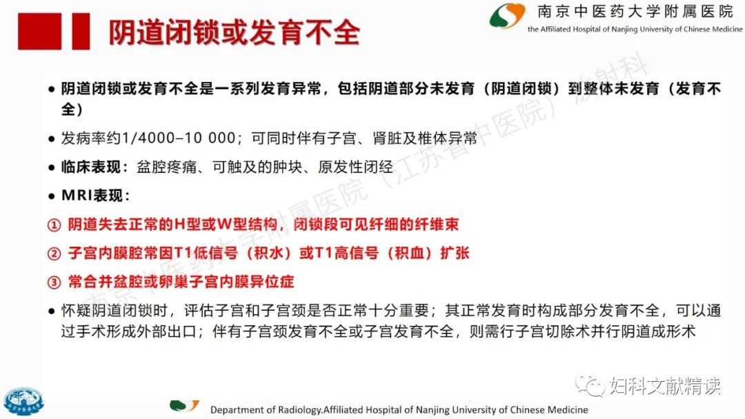 影像PPT - 【PPT】阴道病变影像诊断汇总-13 影像PPT - 【PPT】阴道病变影像诊断汇总-13