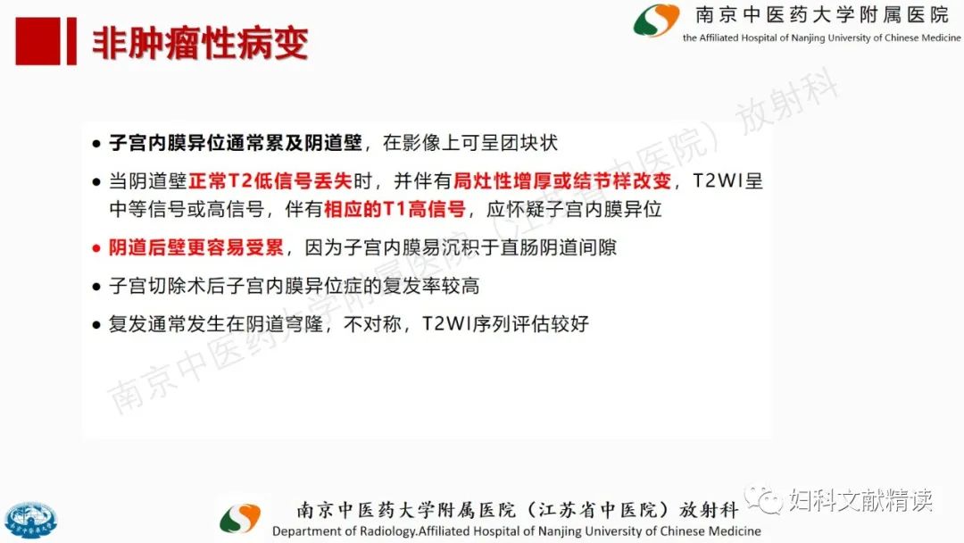 影像PPT - 【PPT】阴道病变影像诊断汇总-31 影像PPT - 【PPT】阴道病变影像诊断汇总-31