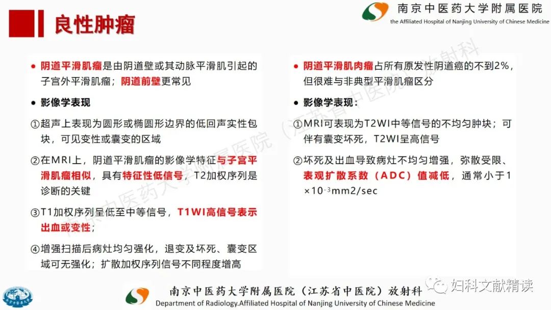 影像PPT - 【PPT】阴道病变影像诊断汇总-35 影像PPT - 【PPT】阴道病变影像诊断汇总-35