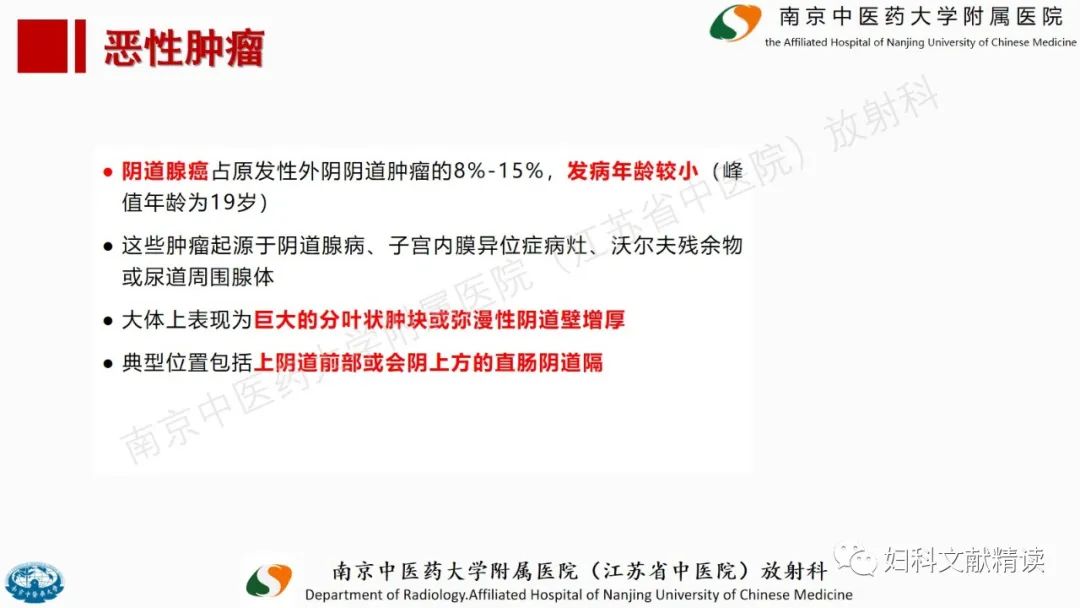 影像PPT - 【PPT】阴道病变影像诊断汇总-43 影像PPT - 【PPT】阴道病变影像诊断汇总-43