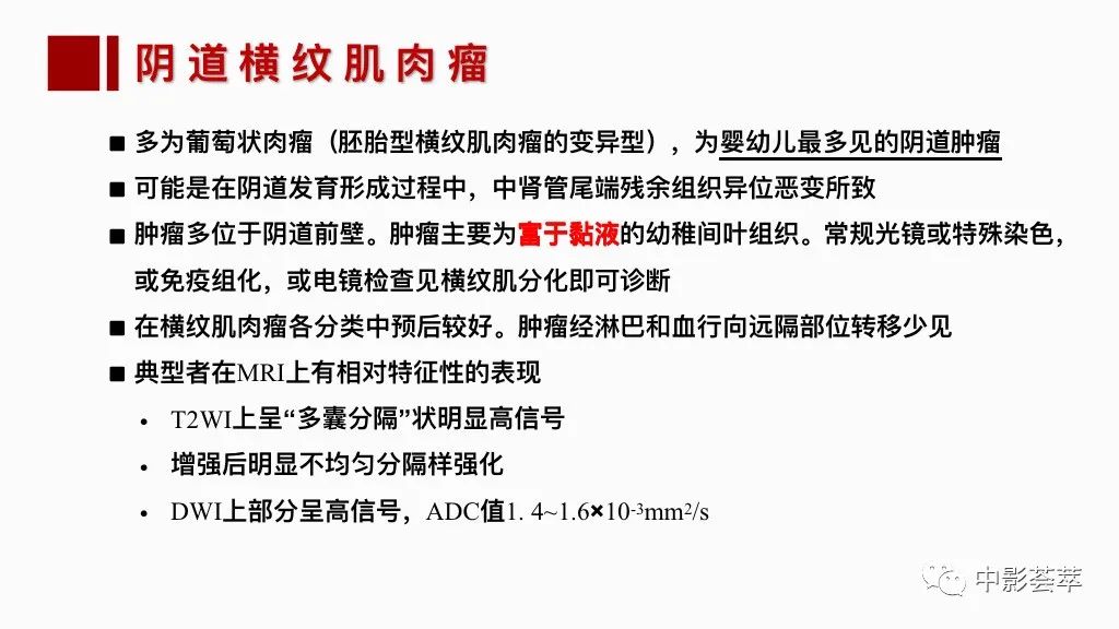 影像PPT - 【PPT】阴道病变影像诊断汇总-58 影像PPT - 【PPT】阴道病变影像诊断汇总-58