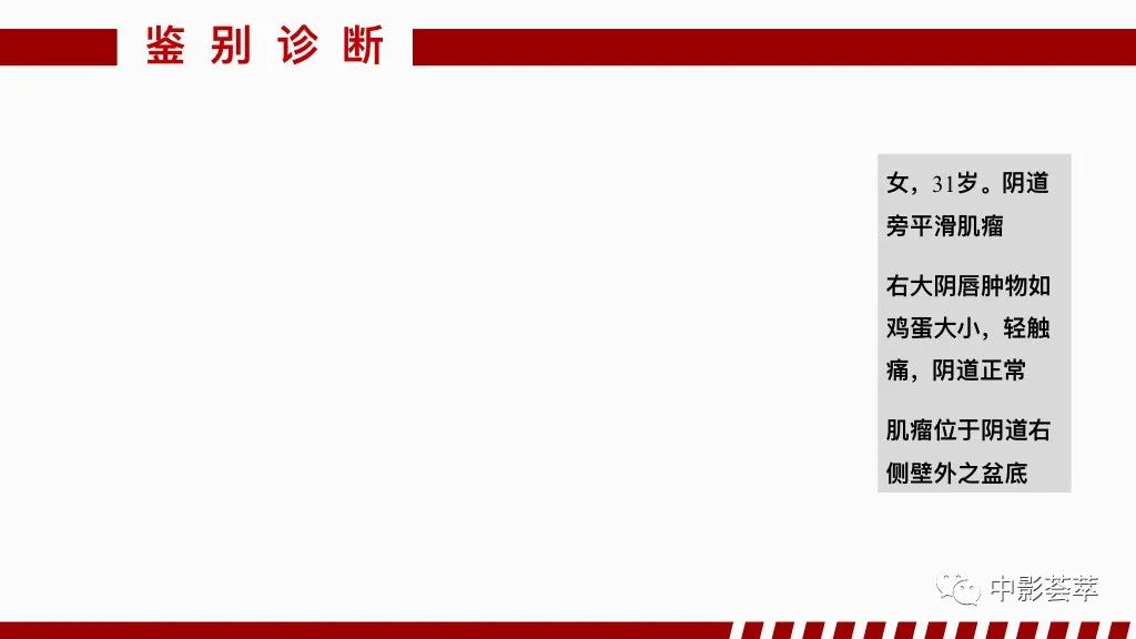 影像PPT - 【PPT】阴道病变影像诊断汇总-86 影像PPT - 【PPT】阴道病变影像诊断汇总-86