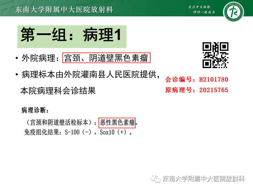 影像PPT - 【PPT】阴道病变影像诊断汇总-113 影像PPT - 【PPT】阴道病变影像诊断汇总-113