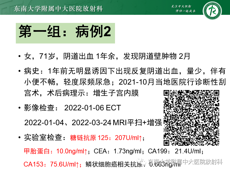 影像PPT - 【PPT】阴道病变影像诊断汇总-114 影像PPT - 【PPT】阴道病变影像诊断汇总-114