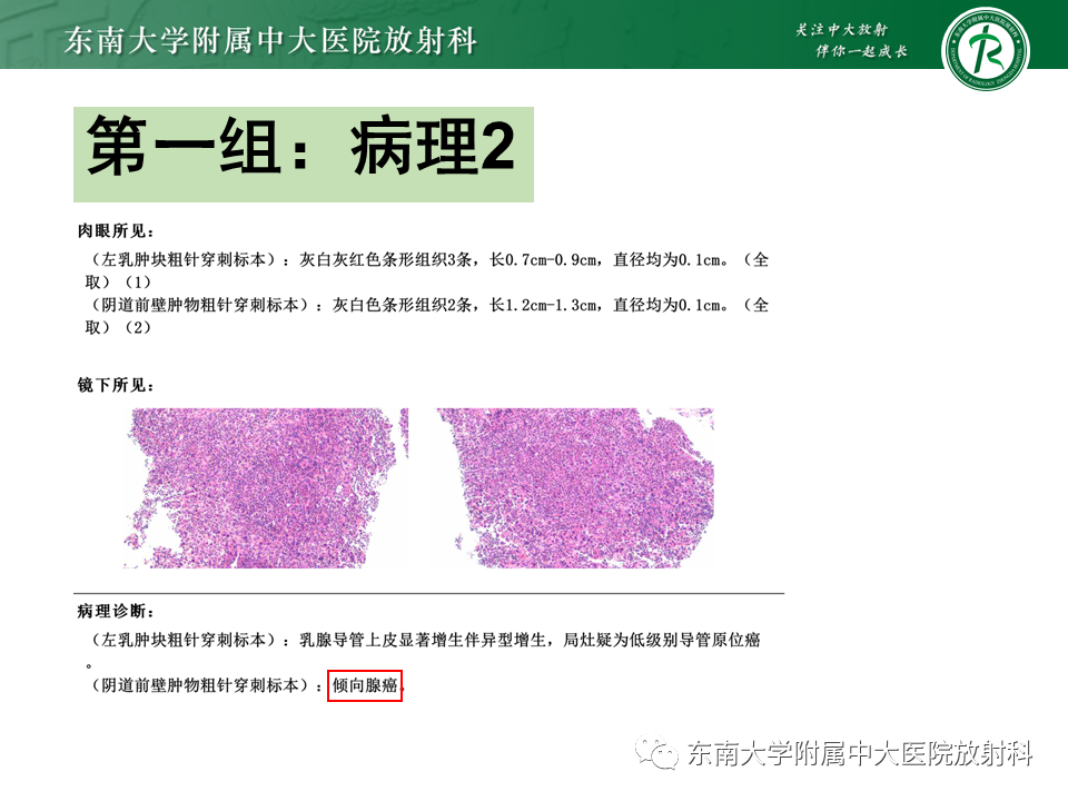 影像PPT - 【PPT】阴道病变影像诊断汇总-118 影像PPT - 【PPT】阴道病变影像诊断汇总-118