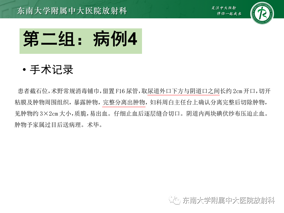 影像PPT - 【PPT】阴道病变影像诊断汇总-127 影像PPT - 【PPT】阴道病变影像诊断汇总-127