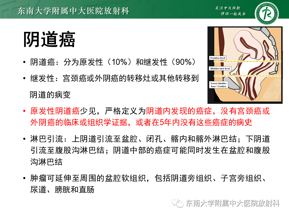 影像PPT - 【PPT】阴道病变影像诊断汇总-135 影像PPT - 【PPT】阴道病变影像诊断汇总-135