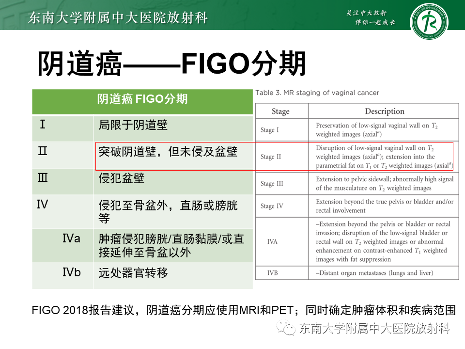 影像PPT - 【PPT】阴道病变影像诊断汇总-140 影像PPT - 【PPT】阴道病变影像诊断汇总-140