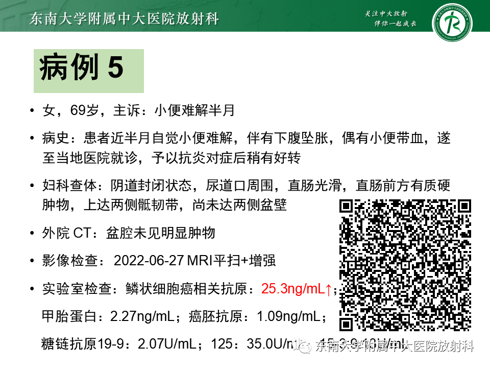 影像PPT - 【PPT】阴道病变影像诊断汇总-144 影像PPT - 【PPT】阴道病变影像诊断汇总-144