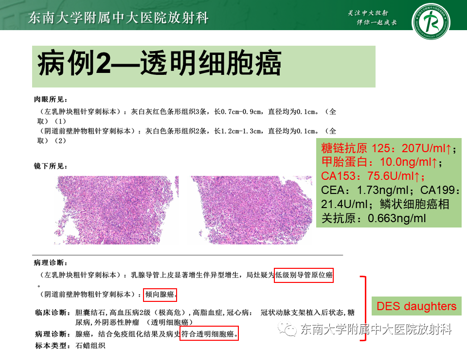 影像PPT - 【PPT】阴道病变影像诊断汇总-153 影像PPT - 【PPT】阴道病变影像诊断汇总-153