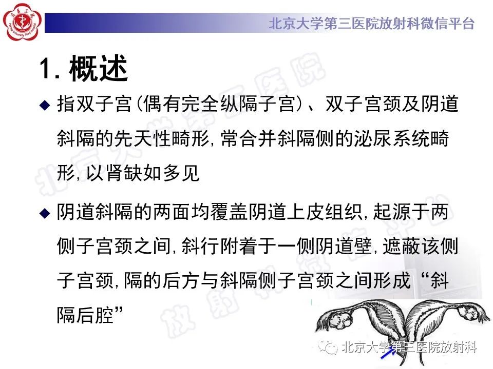 影像PPT - 【PPT】阴道病变影像诊断汇总-182 影像PPT - 【PPT】阴道病变影像诊断汇总-182