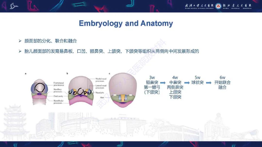 影像PPT - 【PPT】先天性唇腭裂影像诊断-7