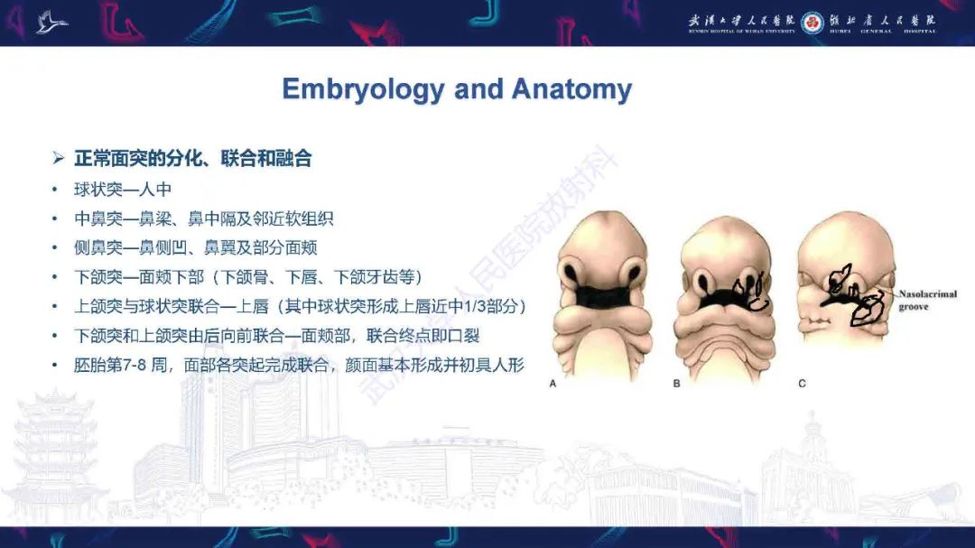 影像PPT - 【PPT】先天性唇腭裂影像诊断-8
