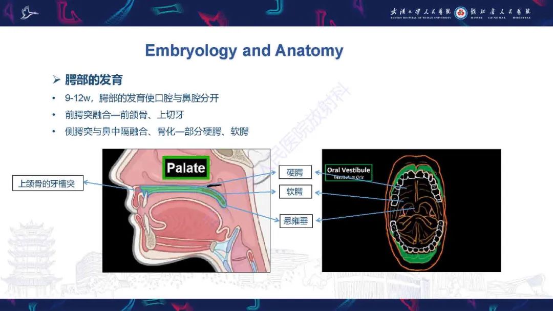 影像PPT - 【PPT】先天性唇腭裂影像诊断-10