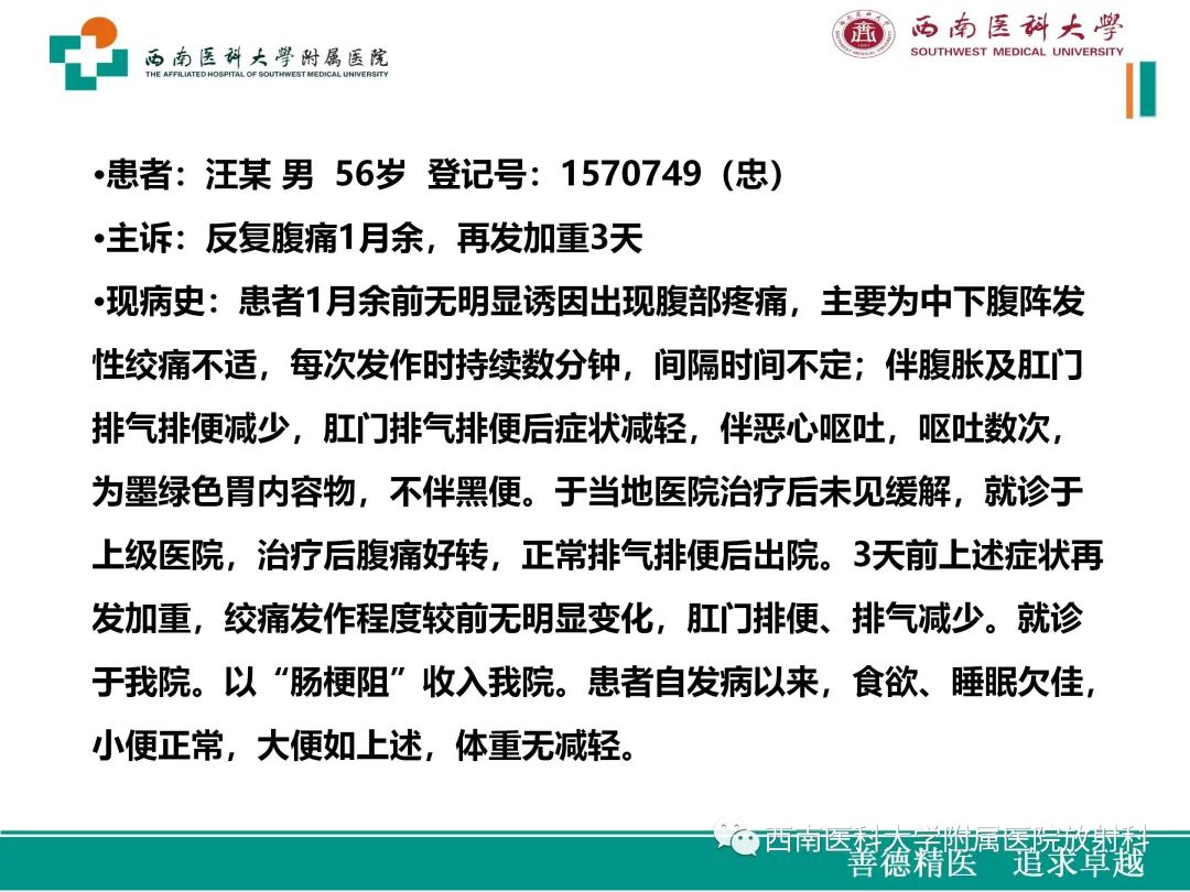 影像PPT - 【病例】原发性消化道恶性黑色素瘤1例CT影像-2