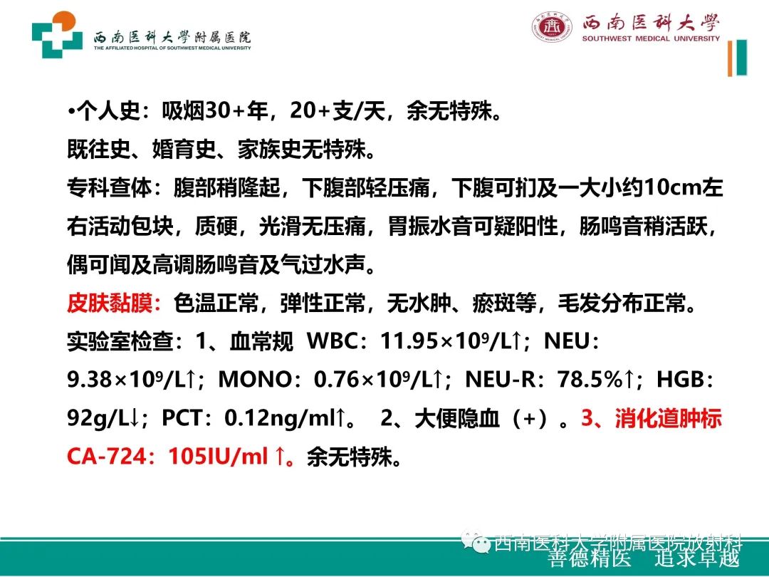 影像PPT - 【病例】原发性消化道恶性黑色素瘤1例CT影像-3