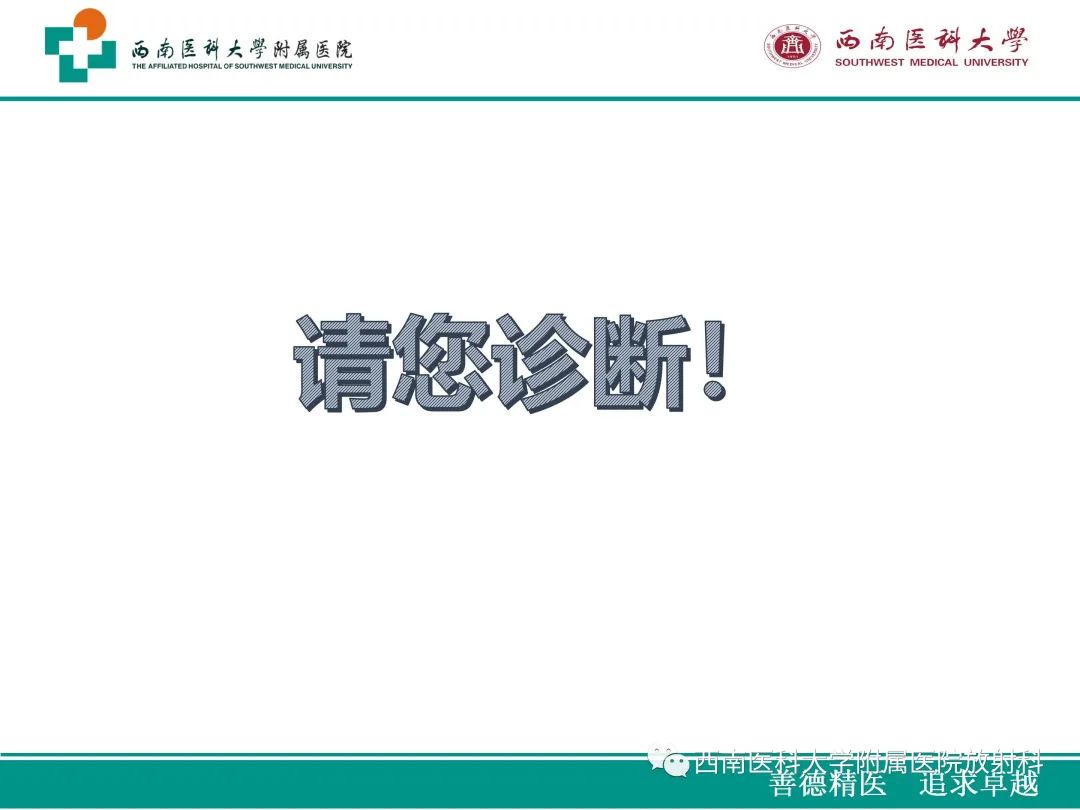 影像PPT - 【病例】原发性消化道恶性黑色素瘤1例CT影像-12
