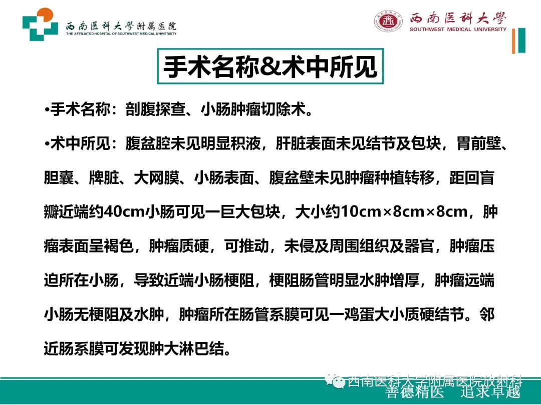 影像PPT - 【病例】原发性消化道恶性黑色素瘤1例CT影像-13