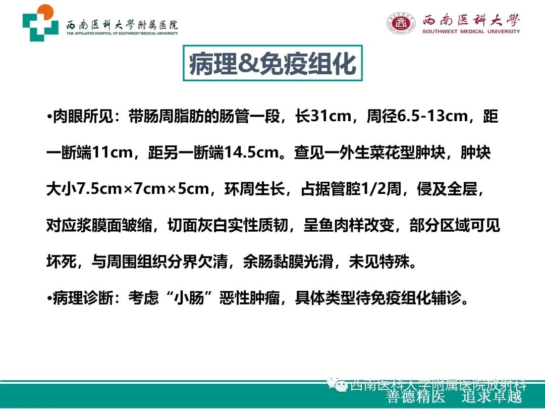 影像PPT - 【病例】原发性消化道恶性黑色素瘤1例CT影像-14