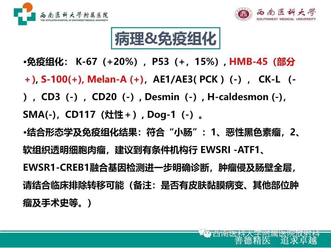 影像PPT - 【病例】原发性消化道恶性黑色素瘤1例CT影像-15
