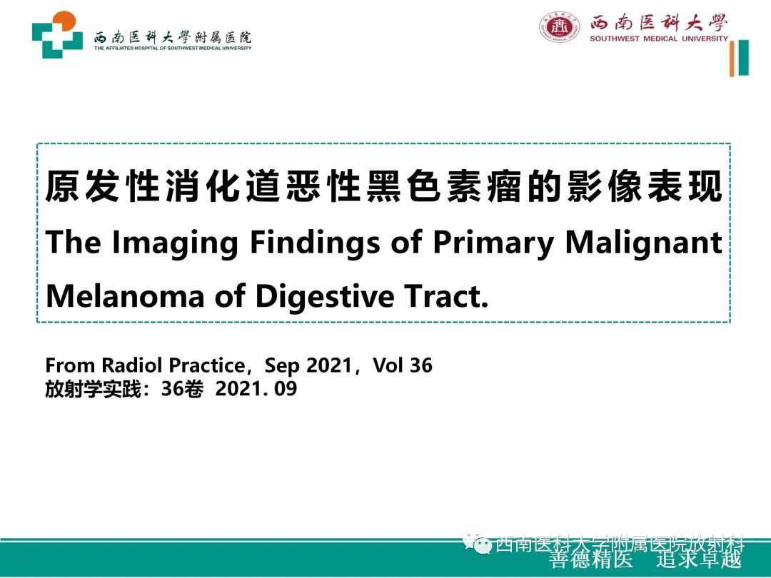影像PPT - 【病例】原发性消化道恶性黑色素瘤1例CT影像-18