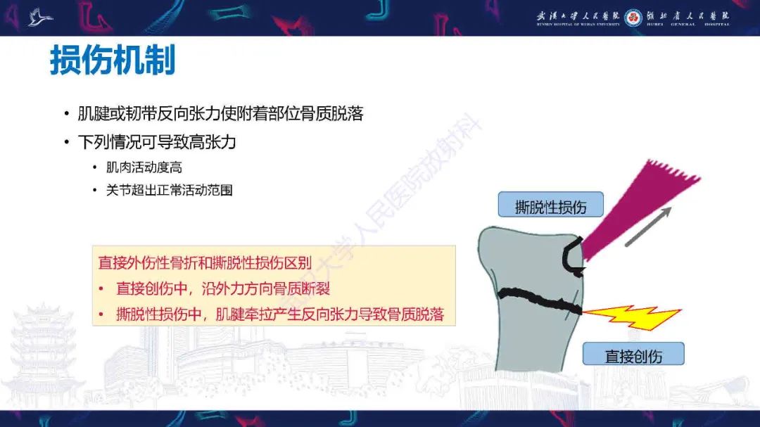 影像PPT - 【PPT】骨关节撕脱性损伤影像诊断-10