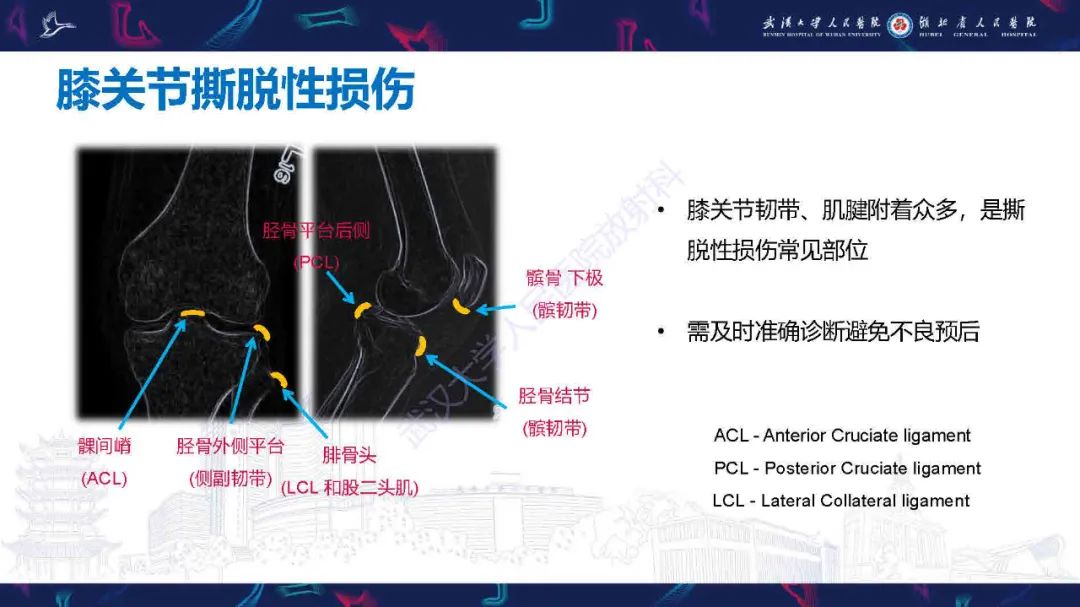 影像PPT - 【PPT】骨关节撕脱性损伤影像诊断-12