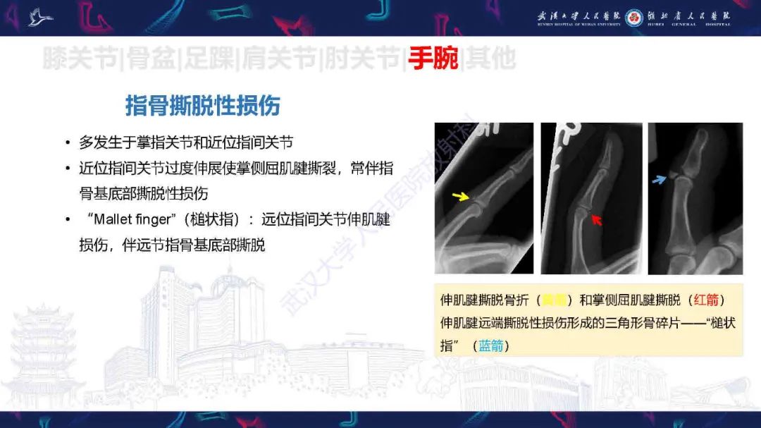 影像PPT - 【PPT】骨关节撕脱性损伤影像诊断-46