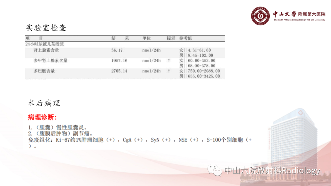 影像PPT - 【PPT】 副神经节瘤影像表现-4