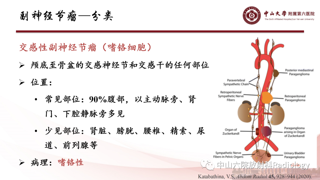 影像PPT - 【PPT】 副神经节瘤影像表现-9