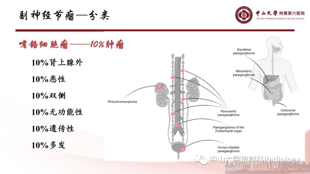 影像PPT - 【PPT】 副神经节瘤影像表现-11