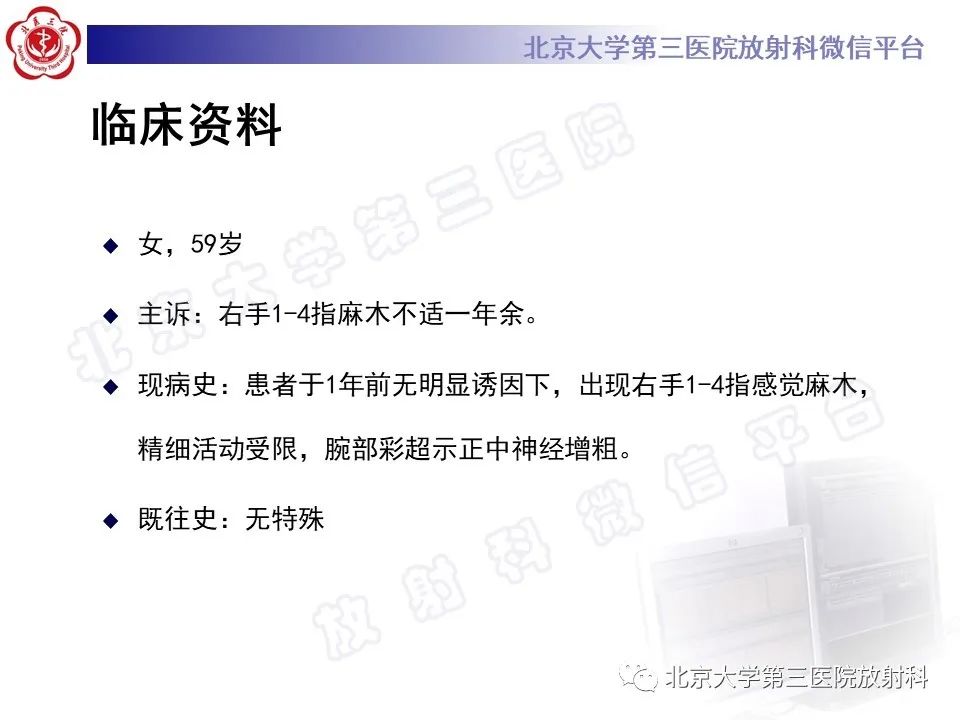 影像PPT - 【PPT】腕管综合征-2