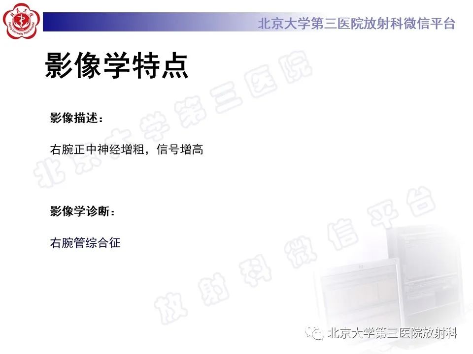 影像PPT - 【PPT】腕管综合征-4