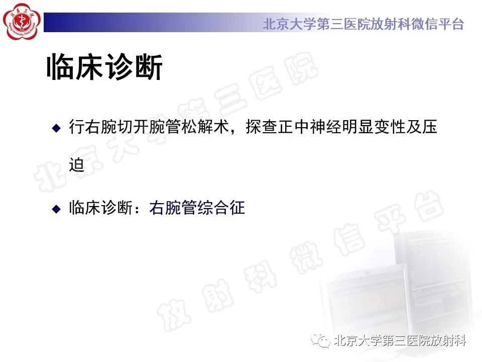 影像PPT - 【PPT】腕管综合征-5