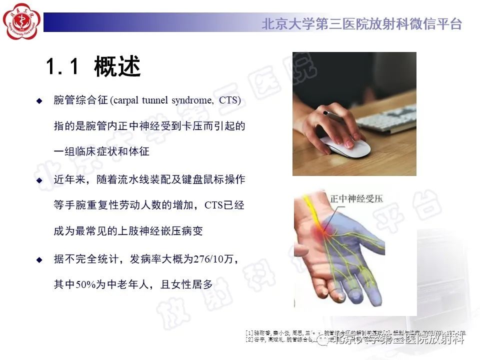 影像PPT - 【PPT】腕管综合征-7