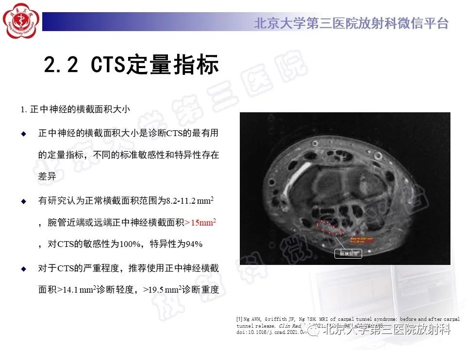 影像PPT - 【PPT】腕管综合征-14