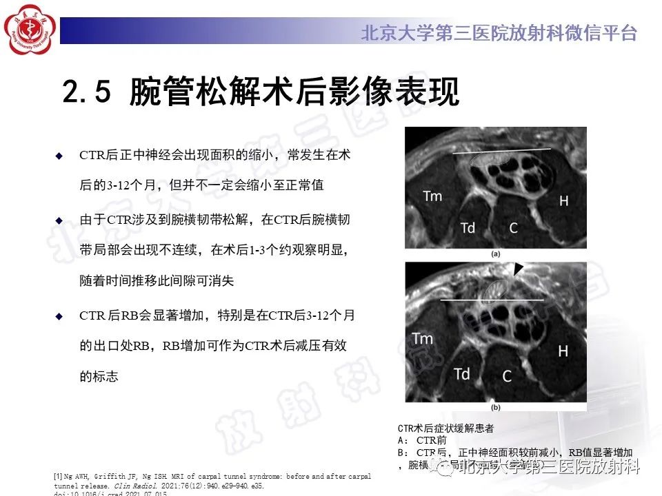 影像PPT - 【PPT】腕管综合征-19