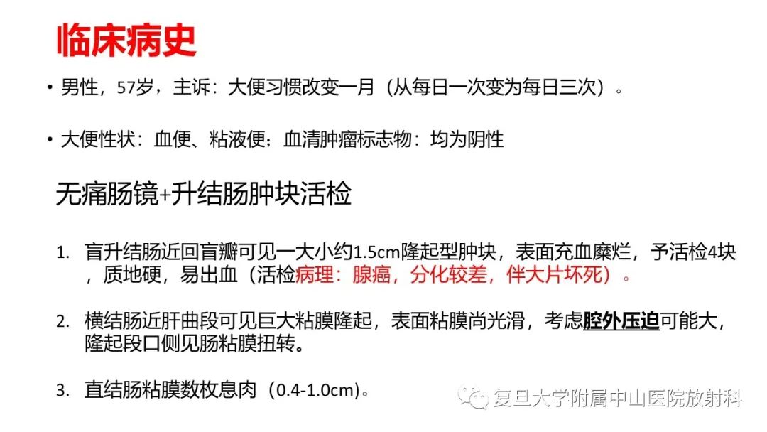 影像PPT - 【病例】肠系膜侵袭性纤维瘤病1例CT及MR影像-2