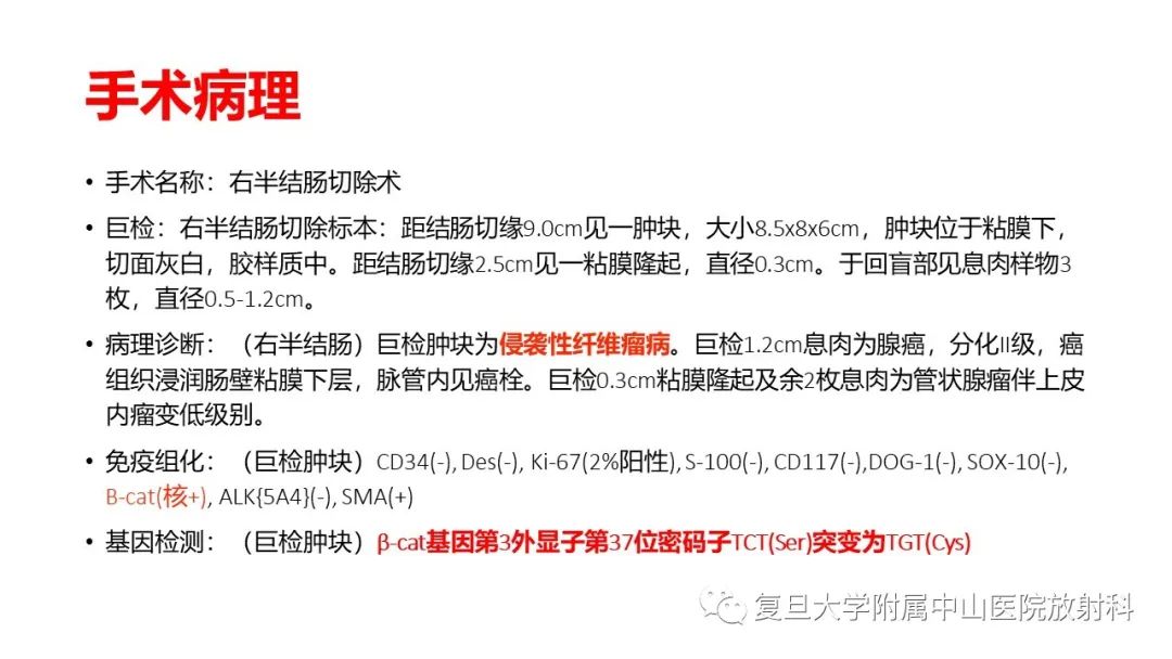 影像PPT - 【病例】肠系膜侵袭性纤维瘤病1例CT及MR影像-6
